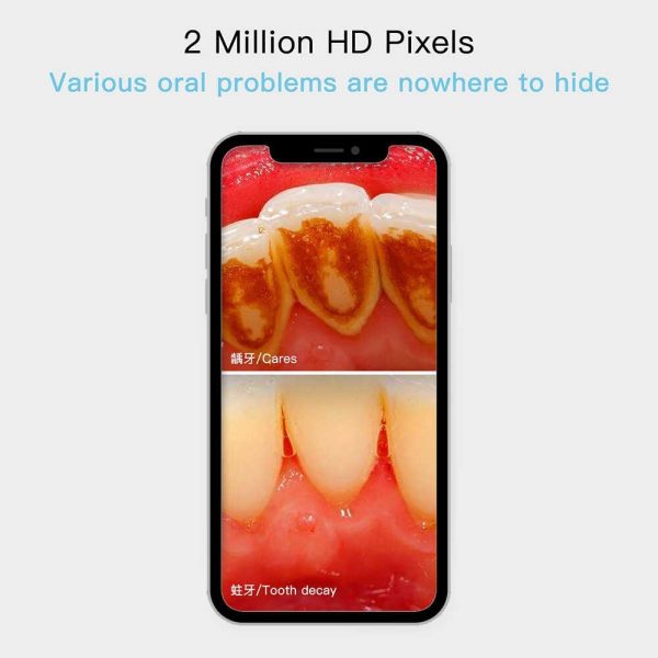  دوربین آندوسکوپی شلنگی داخل دهانی (Dental Camera) - تصویر 6