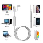 اتوسکوپ،دوربین آندوسکوپی داخل گوش  (Visiual Earpick)