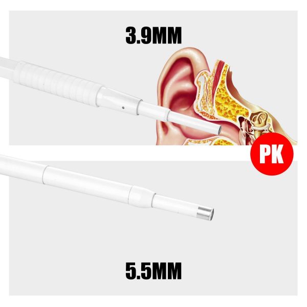 اتوسکوپ ،دوربین آندوسکوپی داخل گوش  (Visiual Earpick) otoscope - تصویر 5